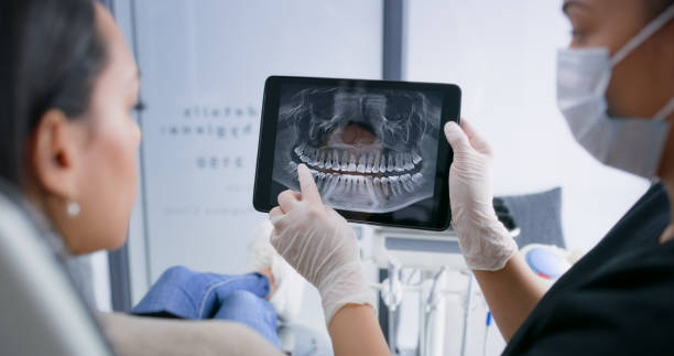Licensed Teeth Whitening service in East Peoria, IL - Smile Center Dentistry